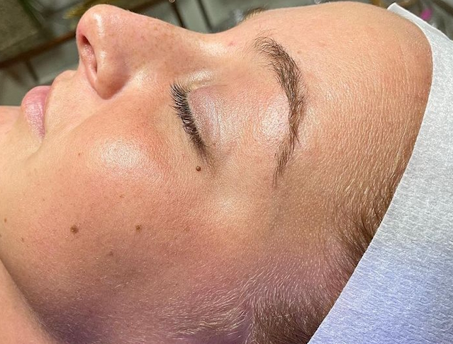 HydraFacial en institut de beauté : tarifs accessibles et résultats visibles pour une peau lumineuse